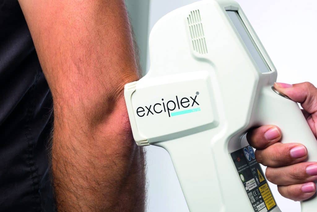 exciplex_excimer light